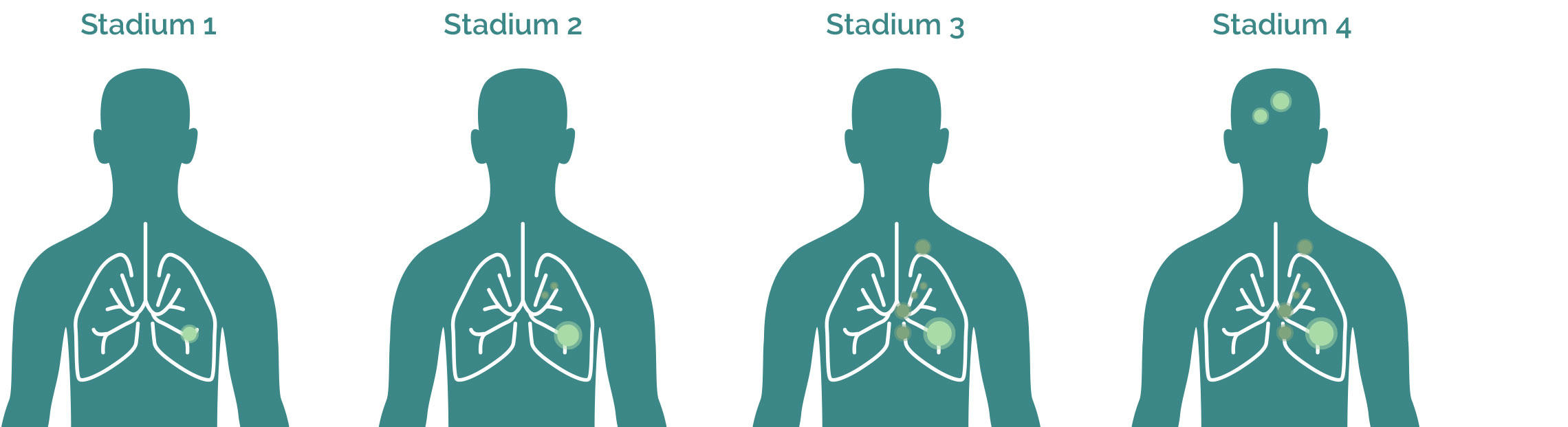 Stadien Grafik