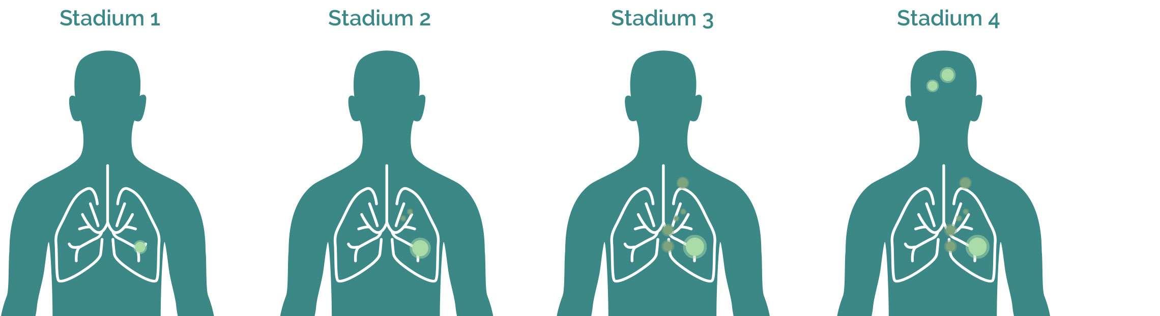 Stadien Grafik