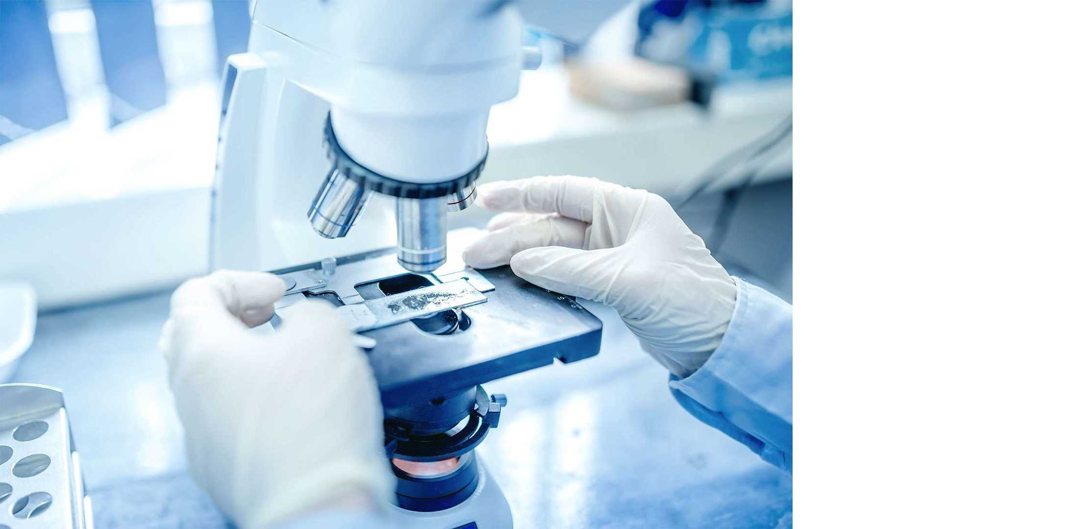 Gewebeuntersuchung (Biopsie)