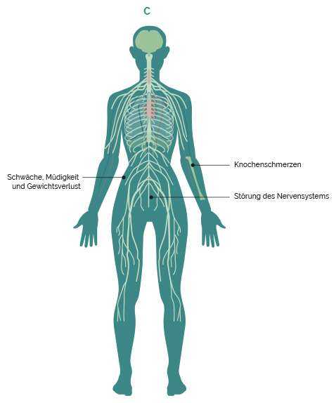 Grafik Beschwerden durch Ausgangtumor 3